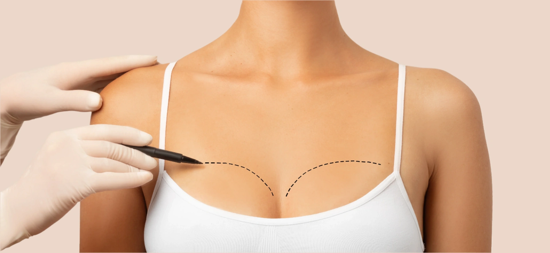 Bruststraffung