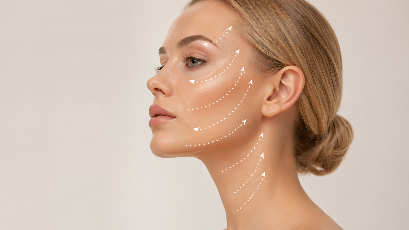 Eigenfetttransplantation